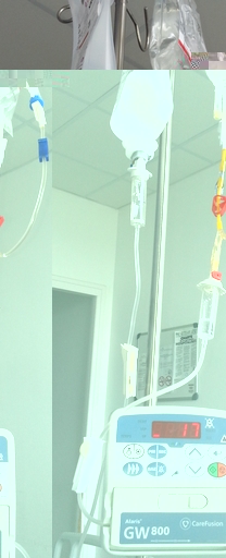 Perf Rituximab début.jpg